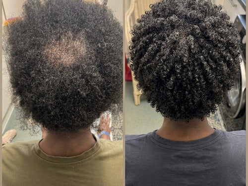 Deep Infused Herbal Hair Growth Oil (150ml) 🌿